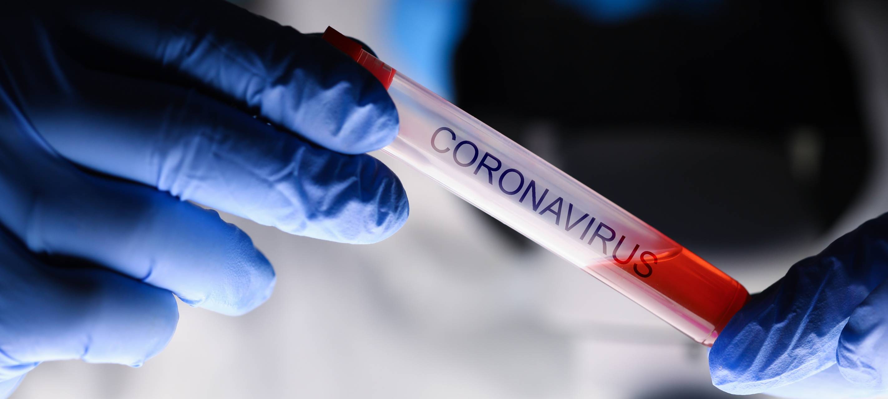 Zahl der Infizierten sinkt