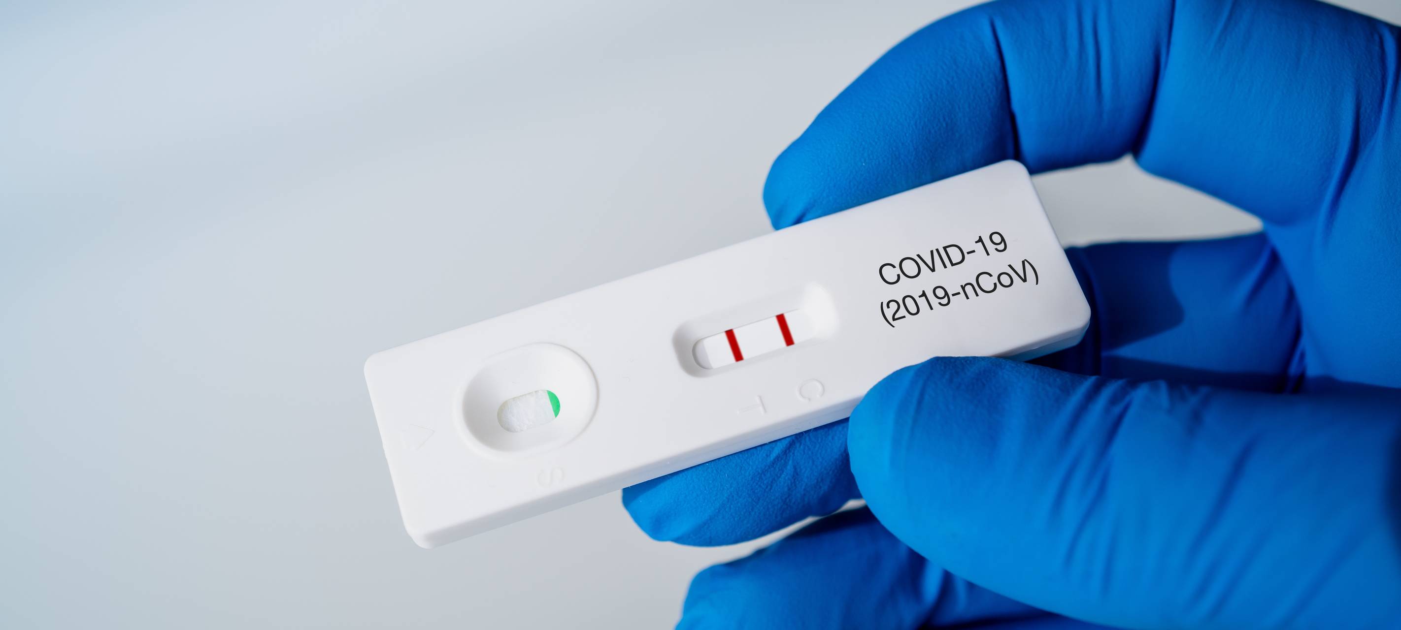 Zahl der Corona-Infektionen steigt leicht