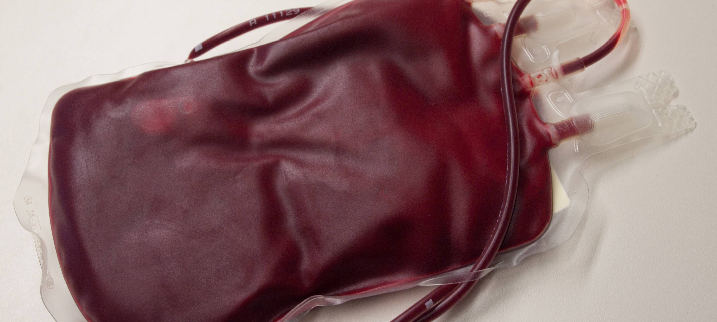 Viele Blutspendeaktionen nur noch mit Termin