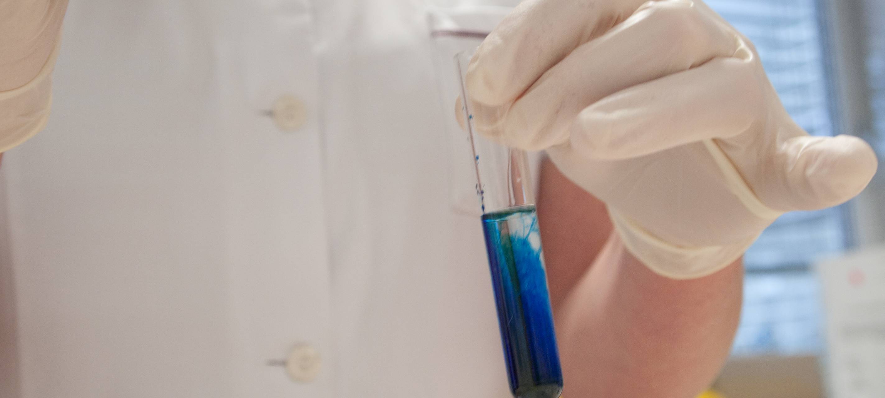 Erfolg für Mönchengladbacher Brüderpaar bei Jugend forscht