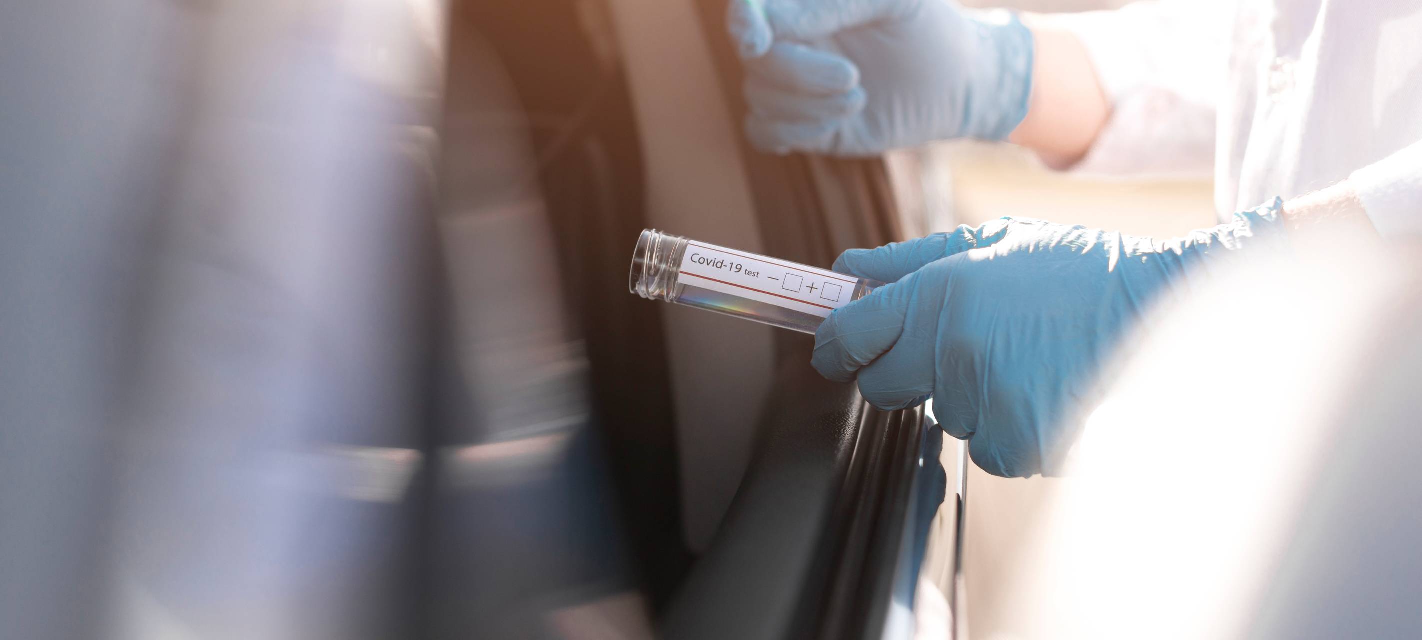 Wenige Mönchengladbacher zahlen für Coronatests