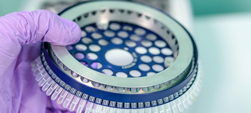 Analyseaufkommen in den Laboren steigt stark