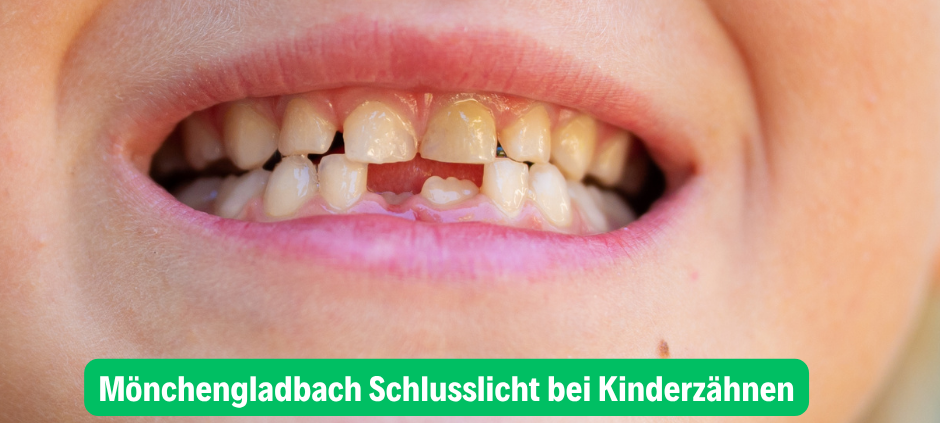 Mönchengladbach Schlusslicht bei Kinderzähnen